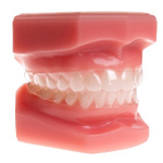 essix retainers